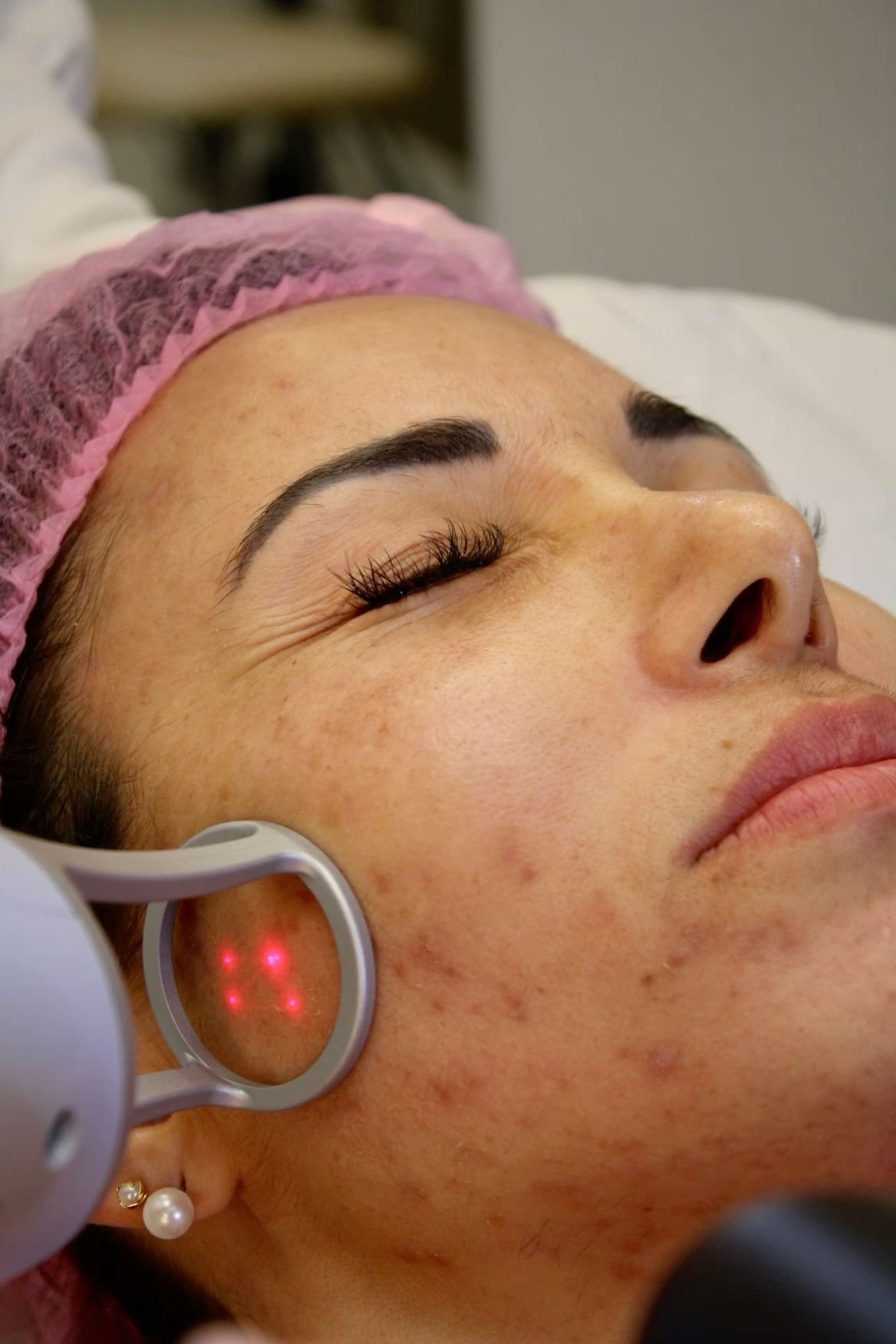 Profesional aplicando tratamiento de medicina estética a paciente